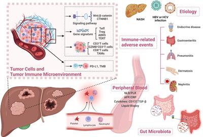 Advanced development of biomarkers for immunotherapy in hepatocellular carcinoma